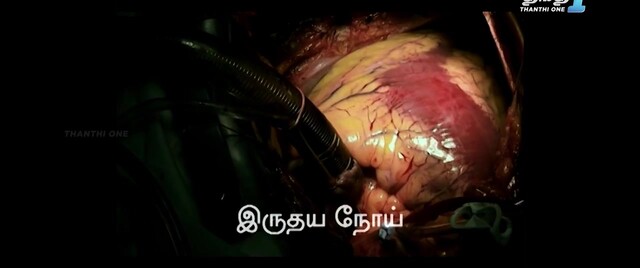 Moviesda.Mobi - Elektra 2010 Original 720p HD.mp4